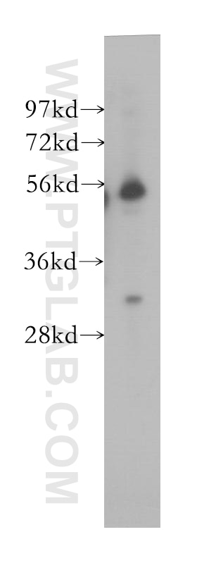 Western Blot (WB) analysis of human placenta tissue using FRS3 Polyclonal antibody (12249-1-AP)