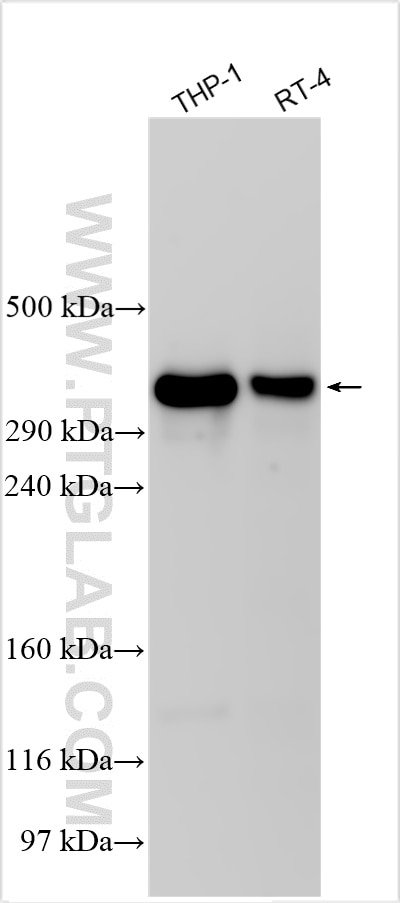 Western Blot (WB) analysis of various lysates using FRY Polyclonal antibody (32075-1-AP)