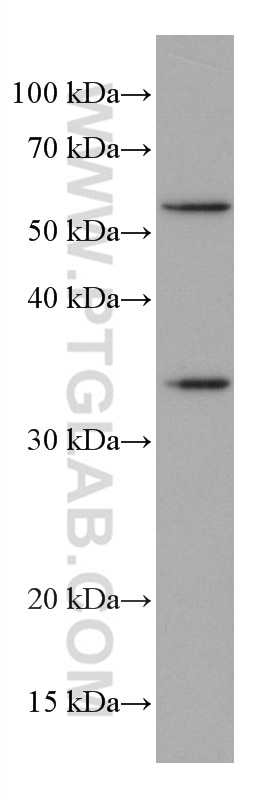 Western Blot (WB) analysis of 4T1 cells using FRZB Monoclonal antibody (67081-1-Ig)