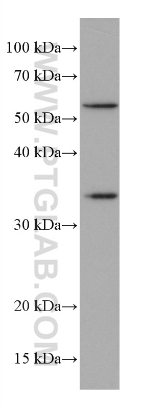 WB analysis of 4T1 using 67081-1-Ig