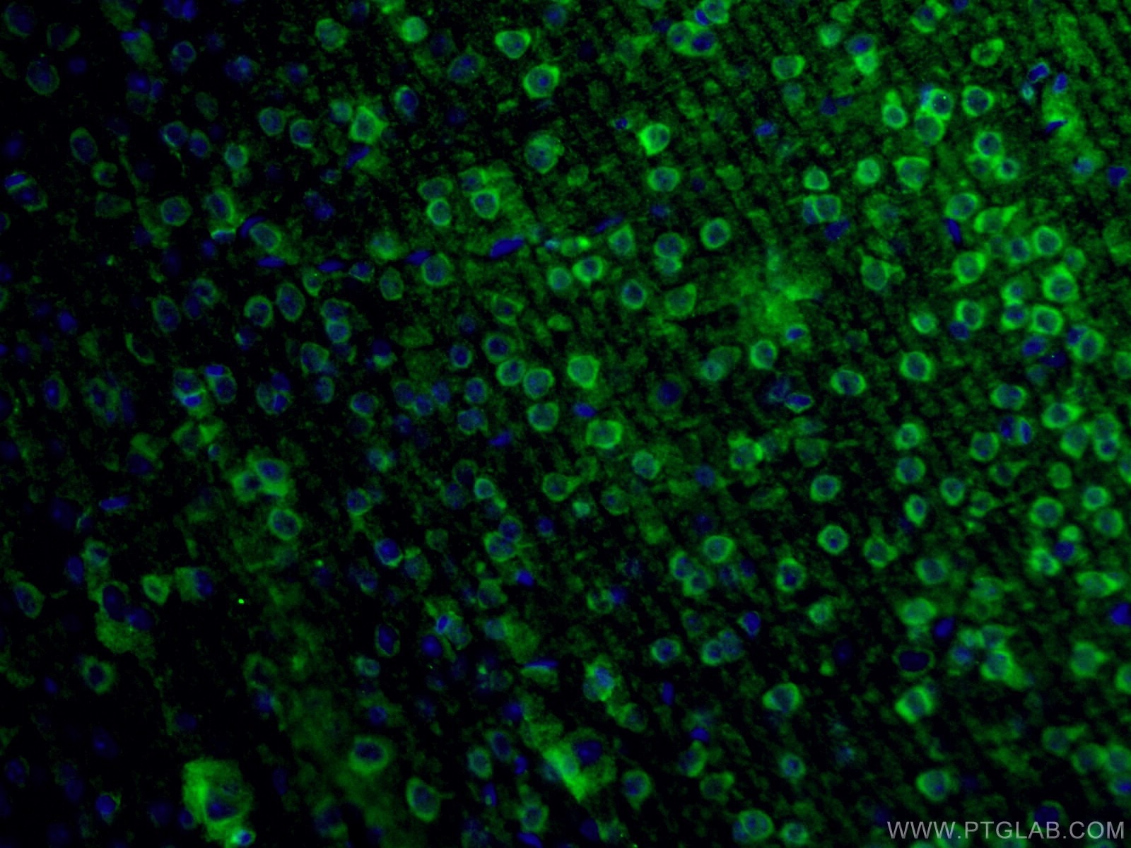 IF Staining of mouse brain using 14384-1-AP