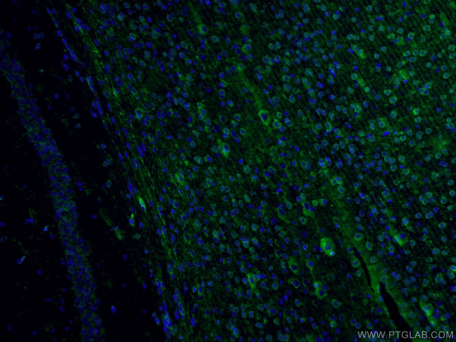 Immunofluorescence (IF) / fluorescent staining of mouse brain tissue using Fascin Polyclonal antibody (14384-1-AP)