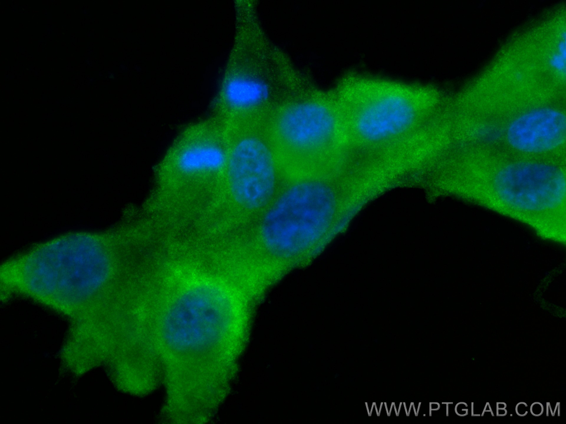 Immunofluorescence (IF) / fluorescent staining of U-87 MG cells using Fascin Polyclonal antibody (14384-1-AP)