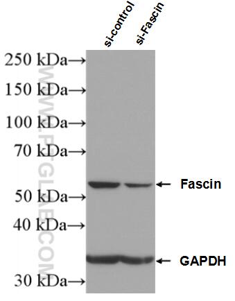 Western Blot (WB) analysis of HeLa cells using Fascin Polyclonal antibody (14384-1-AP)