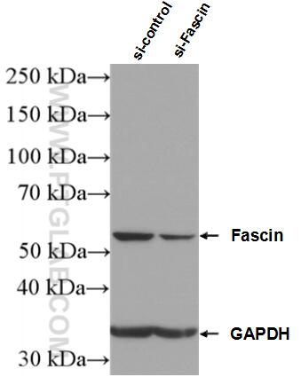 WB analysis of HeLa using 14384-1-AP