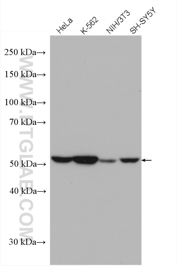 Western Blot (WB) analysis of various lysates using Fascin Polyclonal antibody (14384-1-AP)