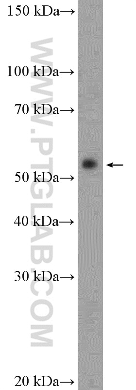 Western Blot (WB) analysis of mouse thymus tissue using Fascin Polyclonal antibody (14384-1-AP)