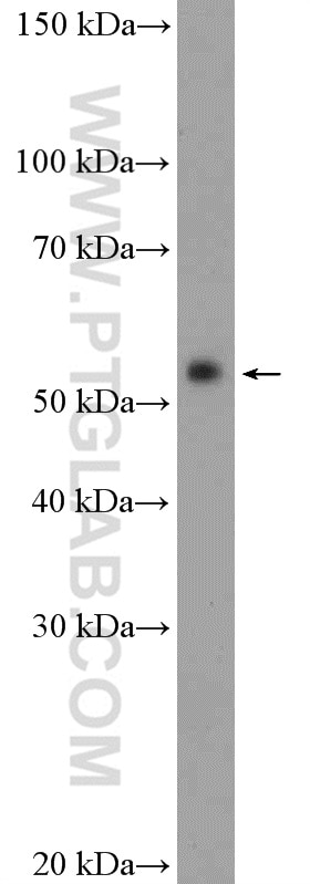 WB analysis of mouse thymus using 14384-1-AP