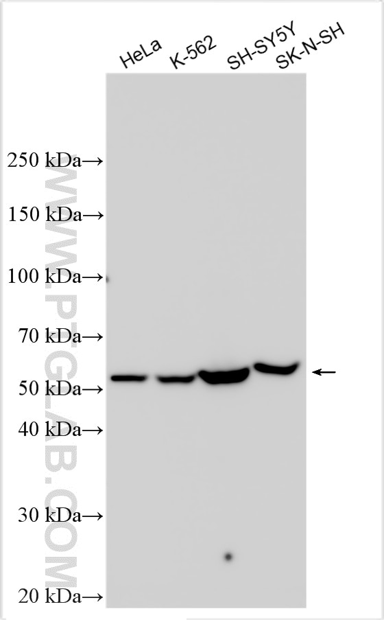 Western Blot (WB) analysis of various lysates using Fascin Polyclonal antibody (14384-1-AP)