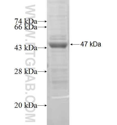 Fascin fusion protein Ag5816 SDS-PAGE