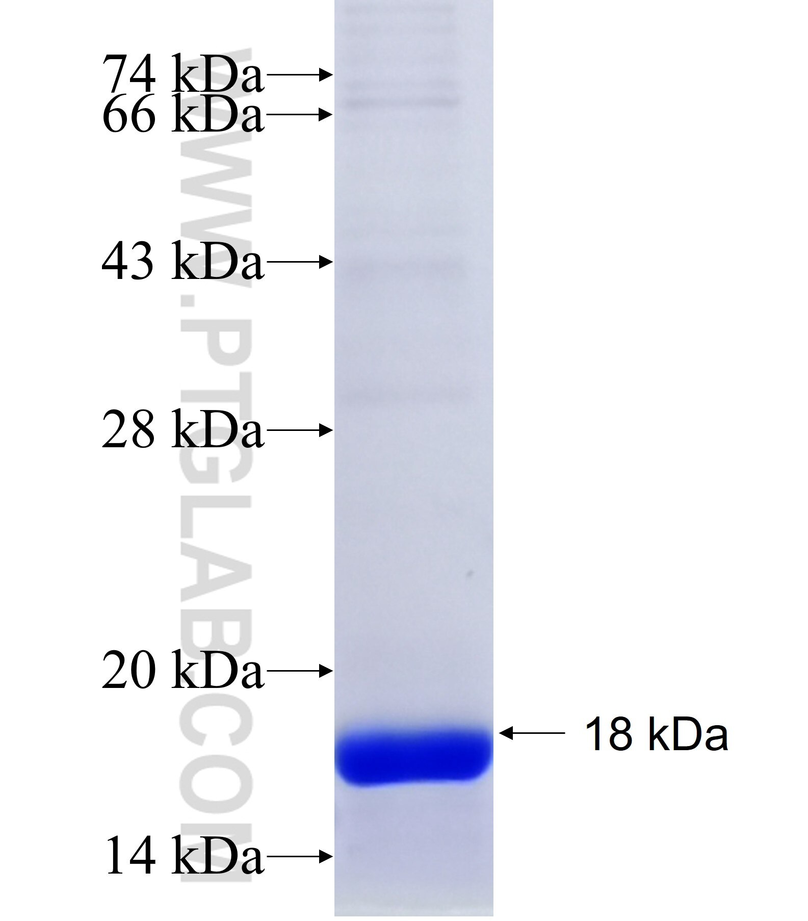 FSCN2 fusion protein Ag20613 SDS-PAGE
