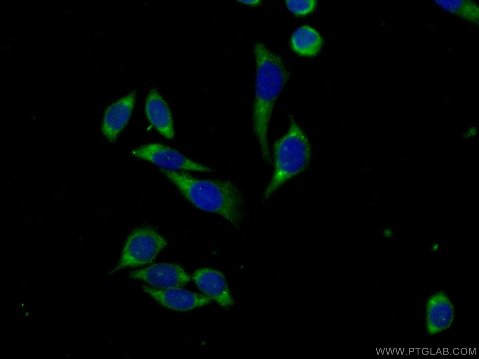Immunofluorescence (IF) / fluorescent staining of PC-3 cells using FSCN3 Polyclonal antibody (13536-1-AP)