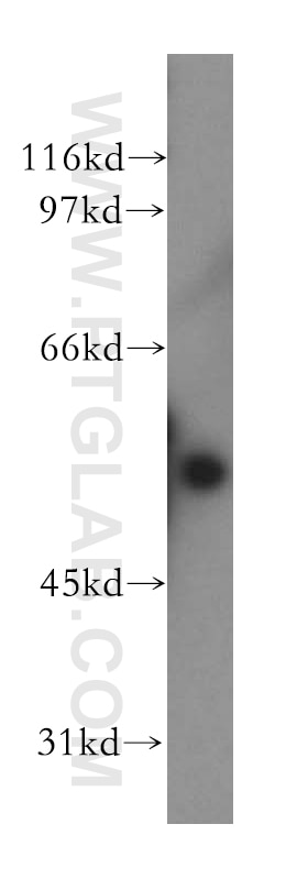 Western Blot (WB) analysis of PC-3 cells using FSCN3 Polyclonal antibody (13536-1-AP)