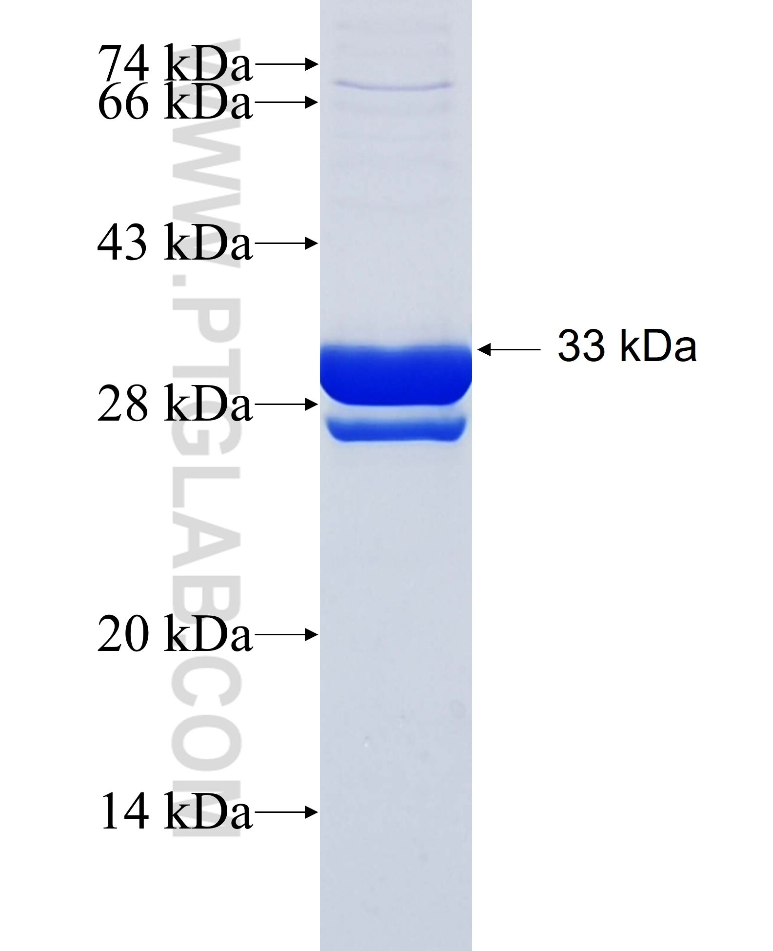 FSD1 fusion protein Ag26566 SDS-PAGE