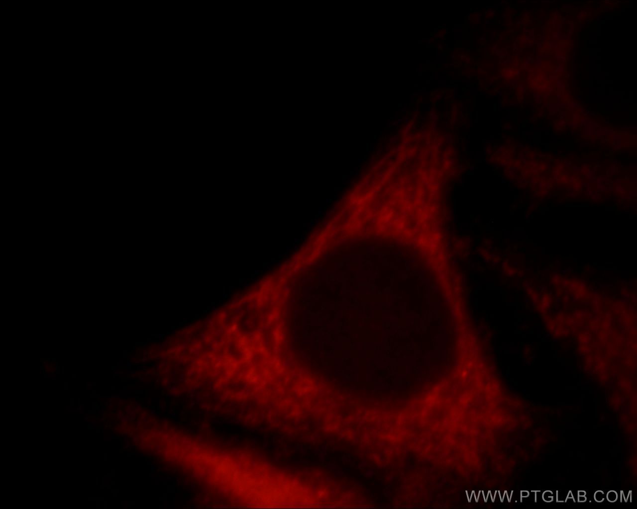 Immunofluorescence (IF) / fluorescent staining of HepG2 cells using FSD1L Polyclonal antibody (21032-1-AP)