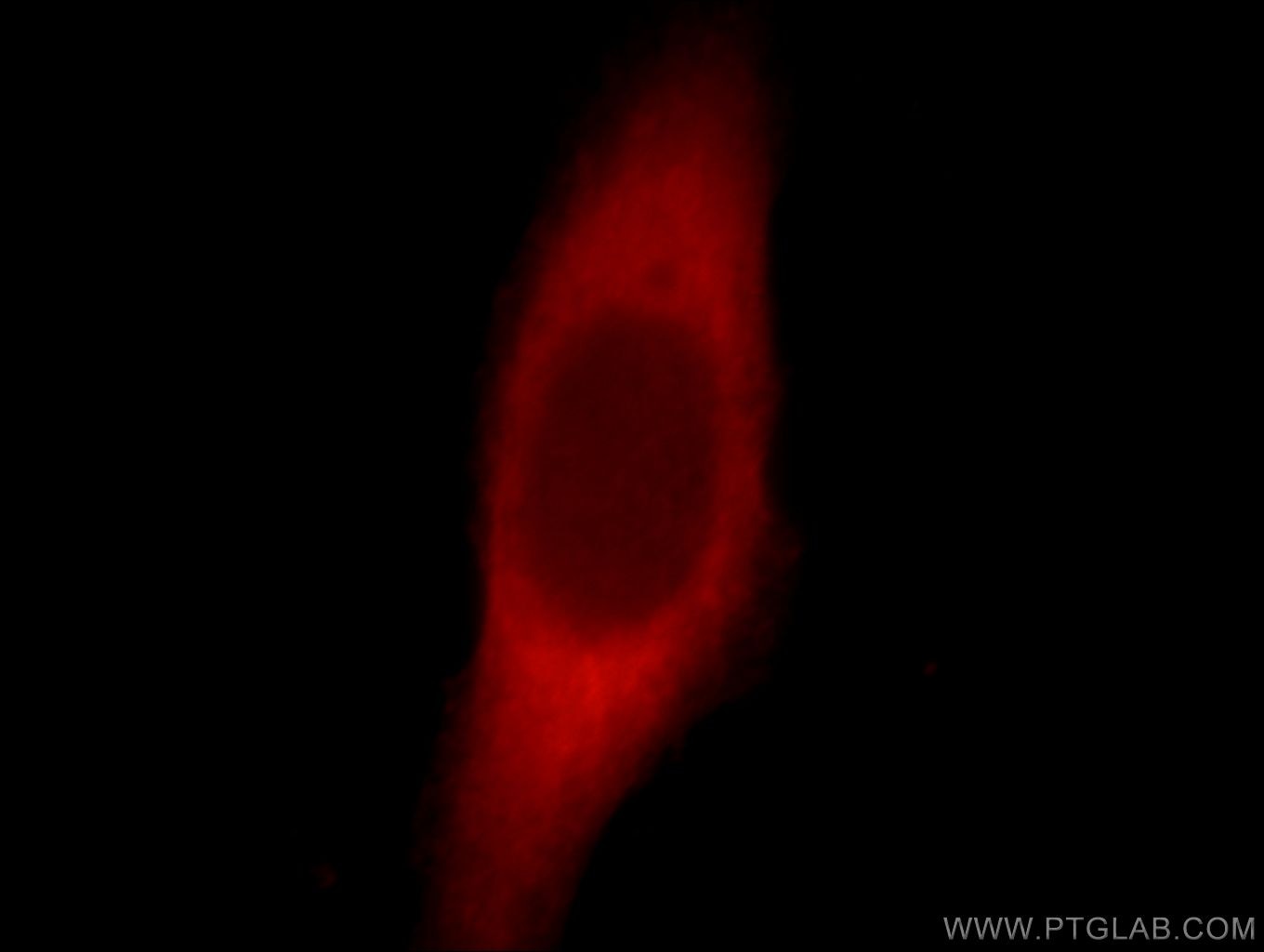 Immunofluorescence (IF) / fluorescent staining of HeLa cells using FSD1L Polyclonal antibody (21032-1-AP)