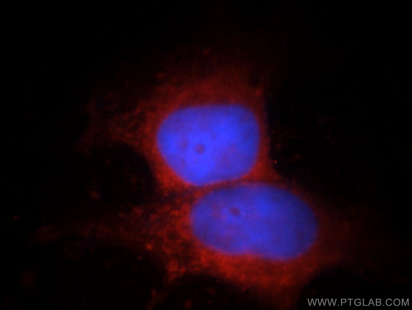 Immunofluorescence (IF) / fluorescent staining of HEK-293 cells using FSD1L Polyclonal antibody (21032-1-AP)