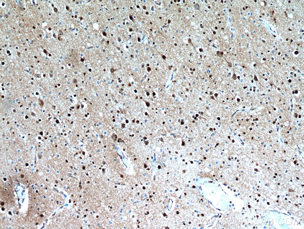 Immunohistochemistry (IHC) staining of human brain tissue using FSD1L Polyclonal antibody (21032-1-AP)