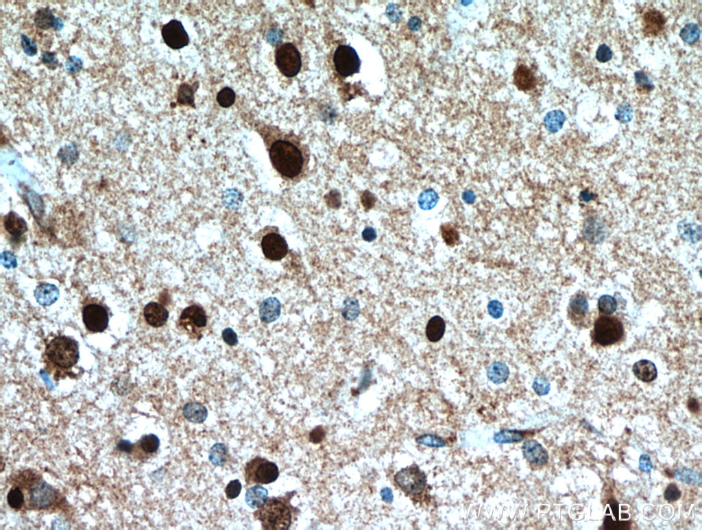 Immunohistochemistry (IHC) staining of human brain tissue using FSD1L Polyclonal antibody (21032-1-AP)