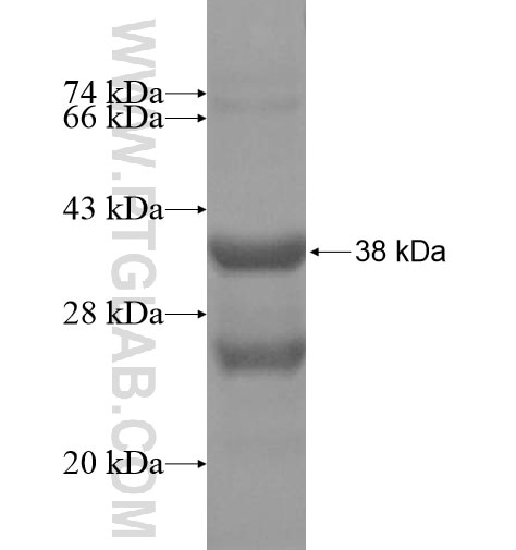 FSD1L fusion protein Ag15345 SDS-PAGE