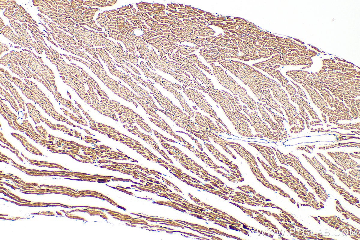 Immunohistochemistry (IHC) staining of mouse heart tissue using FSD2 Polyclonal antibody (25609-1-AP)