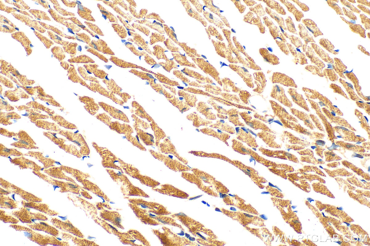 Immunohistochemistry (IHC) staining of mouse heart tissue using FSD2 Polyclonal antibody (25609-1-AP)