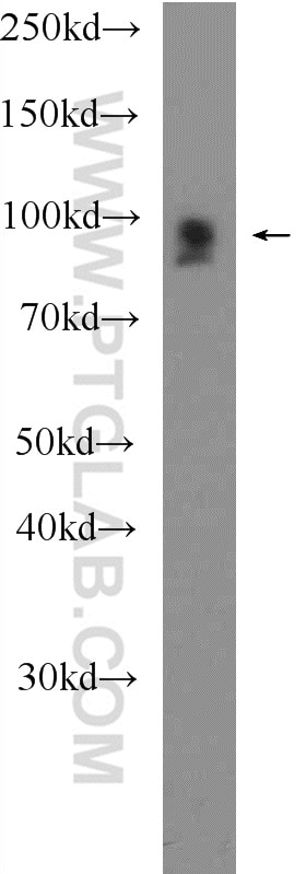 Western Blot (WB) analysis of mouse heart tissue using FSD2 Polyclonal antibody (25609-1-AP)