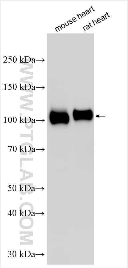 Western Blot (WB) analysis of various lysates using FSD2 Polyclonal antibody (25609-1-AP)