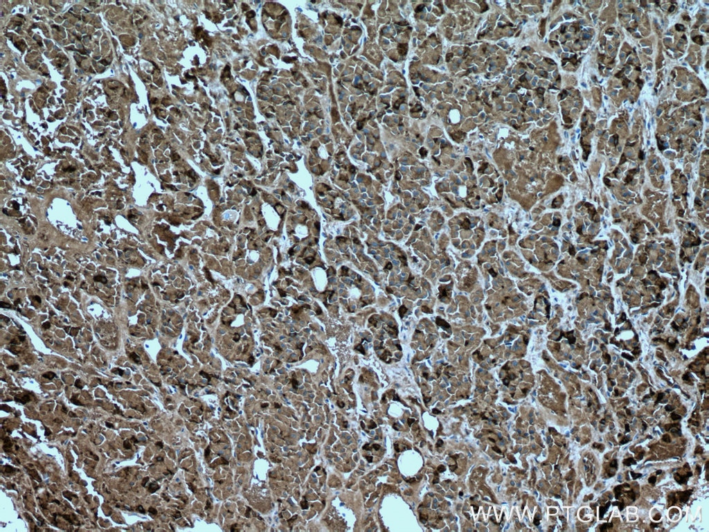 Immunohistochemistry (IHC) staining of human pituitary tissue using FSHB Monoclonal antibody (67131-1-Ig)