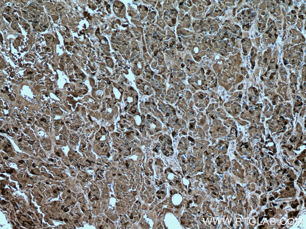 Immunohistochemistry (IHC) staining of human pituitary tissue using FSH beta Monoclonal antibody (67131-1-Ig)