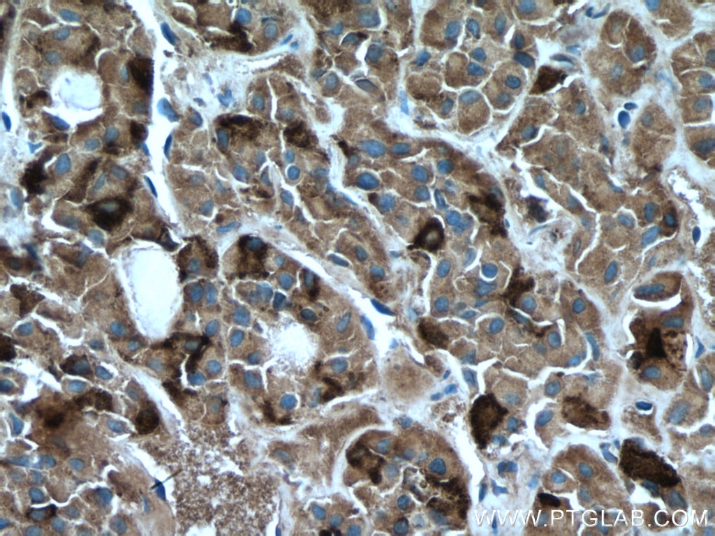 Immunohistochemistry (IHC) staining of human pituitary tissue using FSHB Monoclonal antibody (67131-1-Ig)