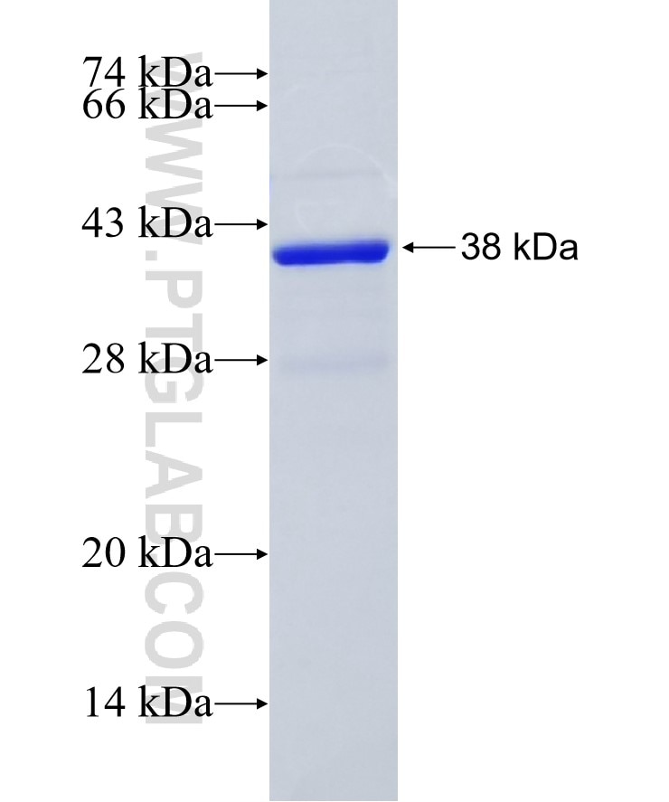 FSHB fusion protein Ag13788 SDS-PAGE