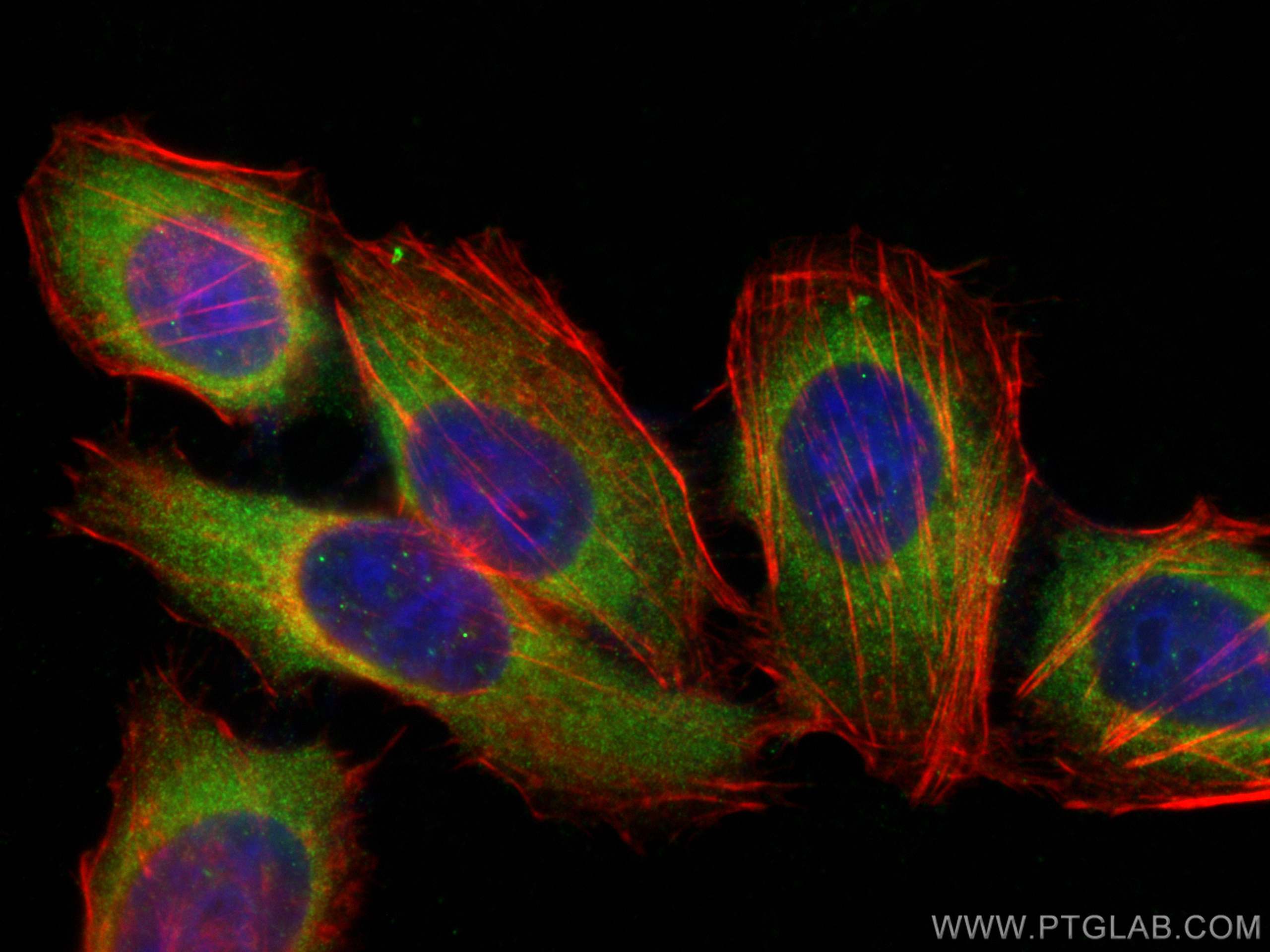 Immunofluorescence (IF) / fluorescent staining of HepG2 cells using FSHR Polyclonal antibody (22665-1-AP)