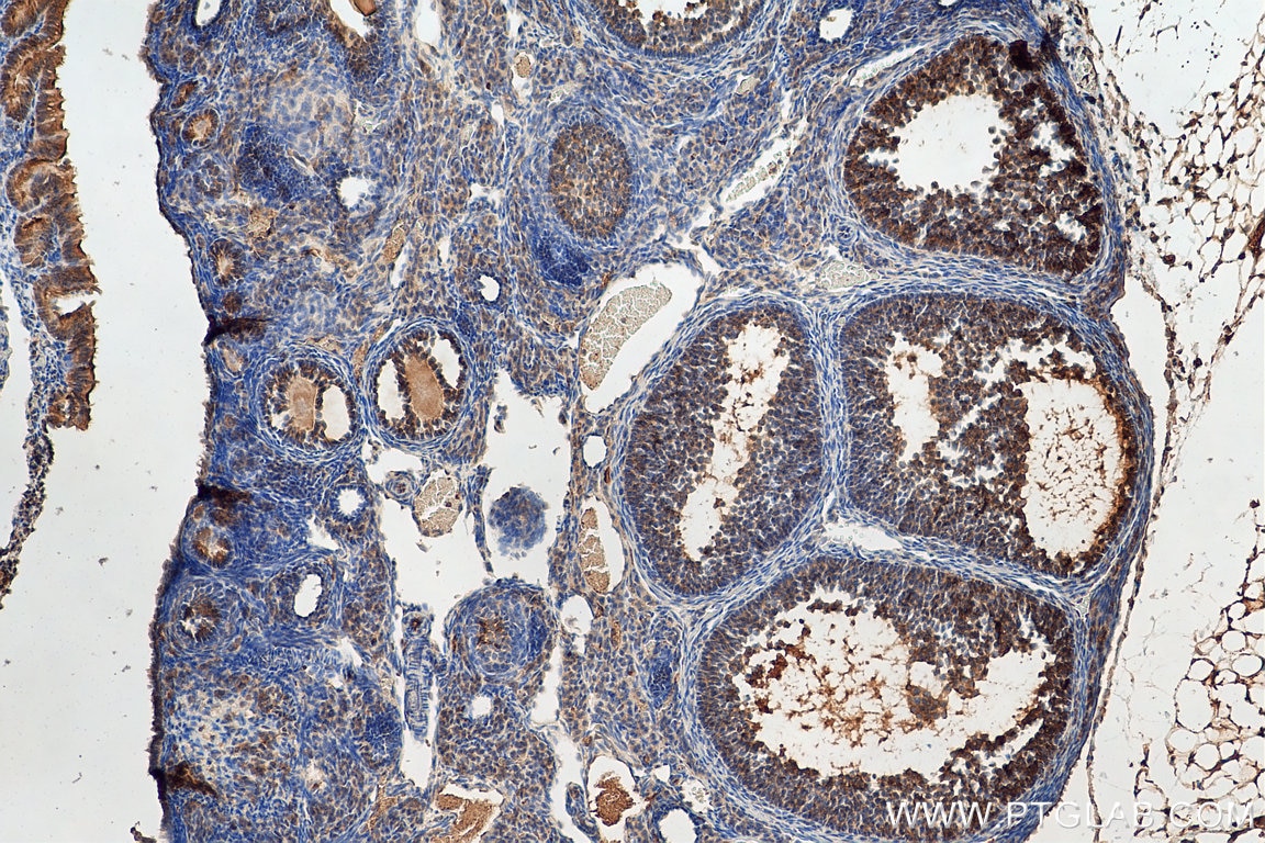 Immunohistochemistry (IHC) staining of mouse ovary tissue using FSHR Polyclonal antibody (22665-1-AP)