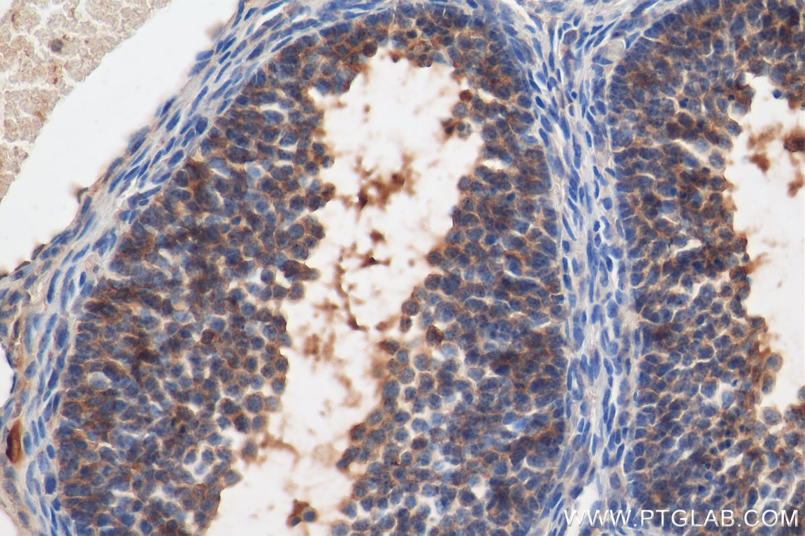 Immunohistochemistry (IHC) staining of mouse ovary tissue using FSHR Polyclonal antibody (22665-1-AP)