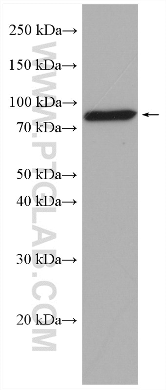 Western Blot (WB) analysis of rat ovary tissue using FSHR Polyclonal antibody (22665-1-AP)