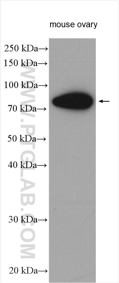 Western Blot (WB) analysis of various lysates using FSHR Polyclonal antibody (22665-1-AP)