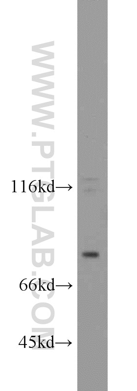 Western Blot (WB) analysis of DU 145 cells using FSHR Polyclonal antibody (22665-1-AP)