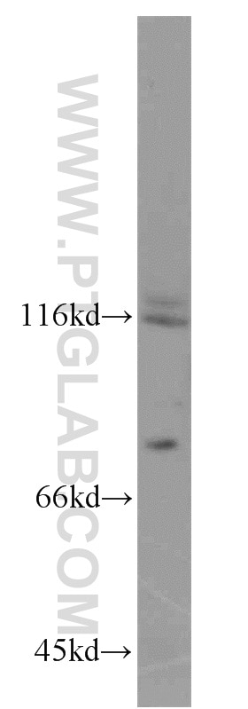 Western Blot (WB) analysis of PC-3 cells using FSHR Polyclonal antibody (22665-1-AP)
