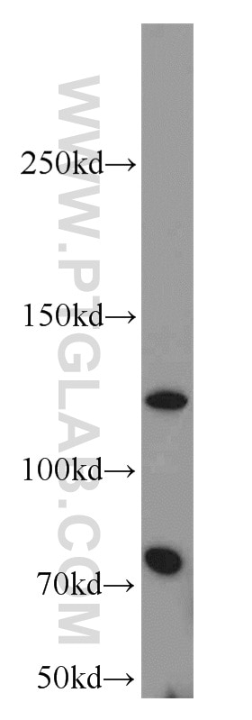 Western Blot (WB) analysis of HeLa cells using FSHR Polyclonal antibody (22665-1-AP)
