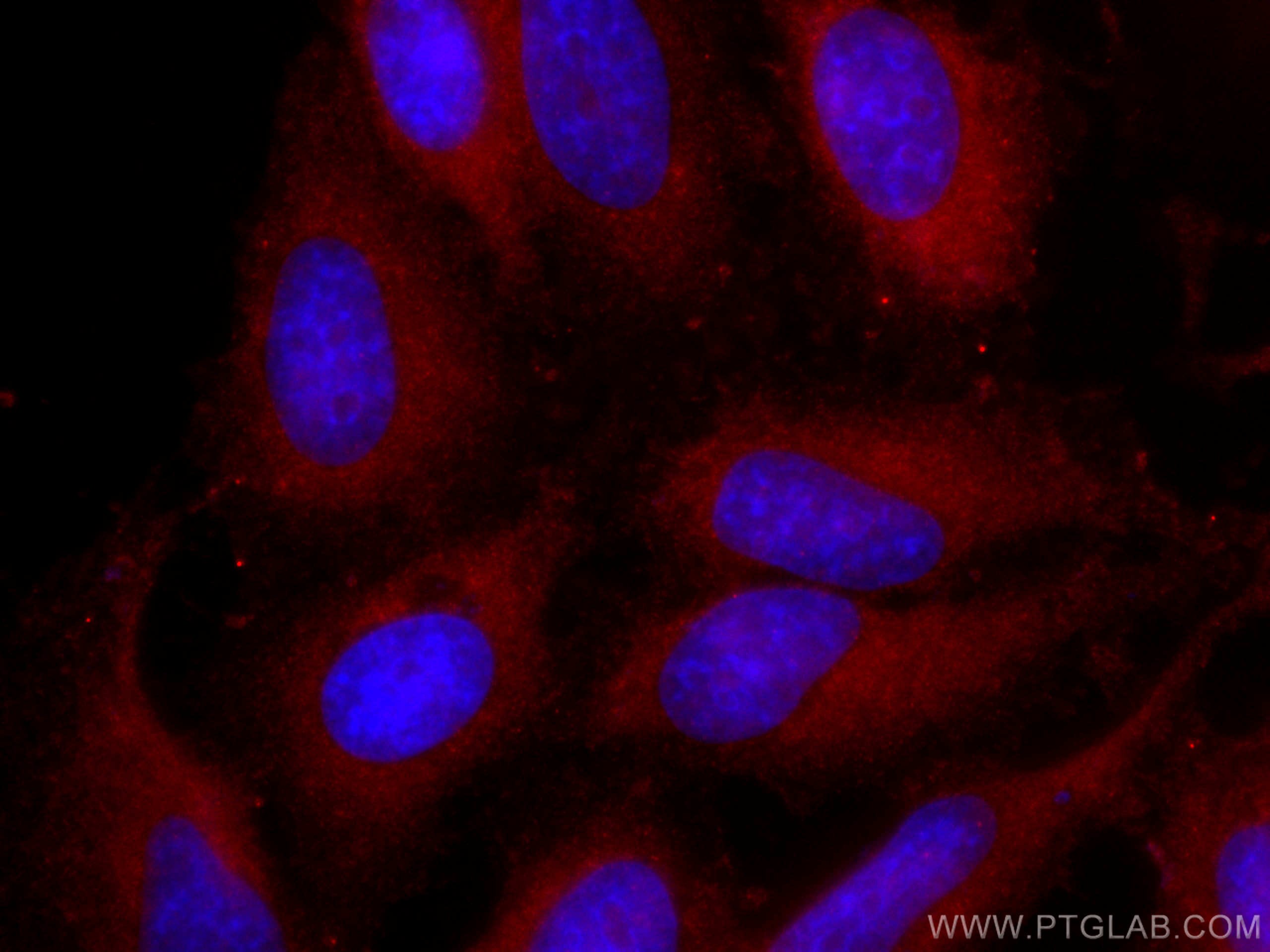 Immunofluorescence (IF) / fluorescent staining of HeLa cells using CoraLite®594-conjugated FSHR Polyclonal antibody (CL594-22665)