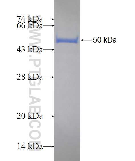 FSHR fusion protein Ag18158 SDS-PAGE