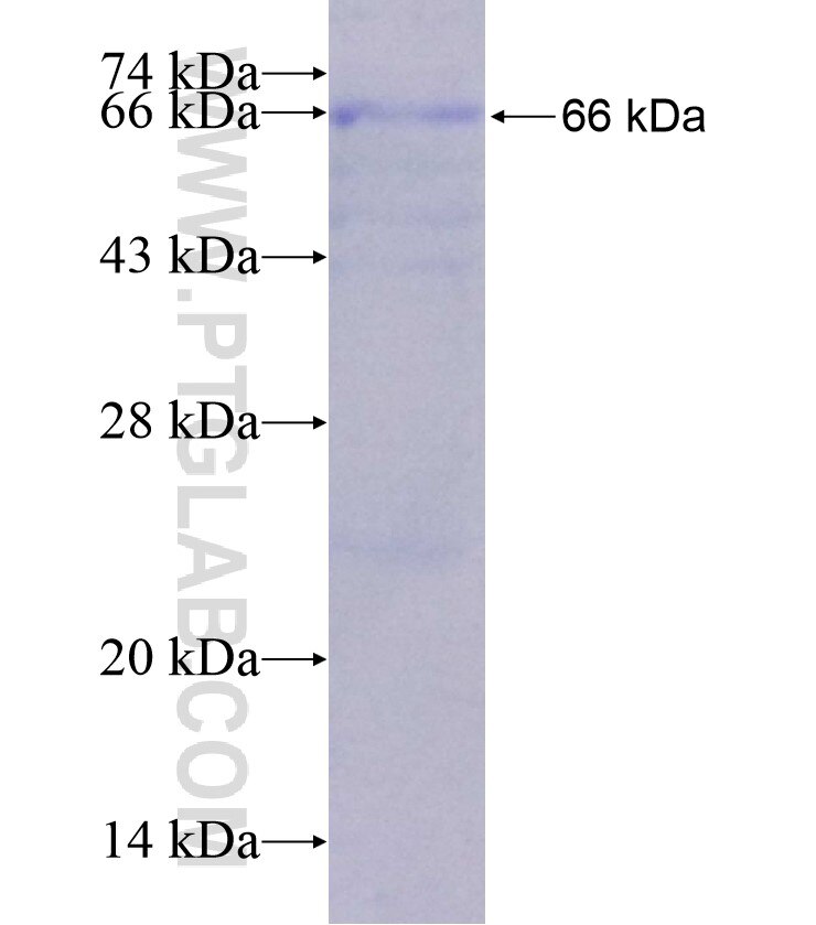 FSHR fusion protein Ag18409 SDS-PAGE
