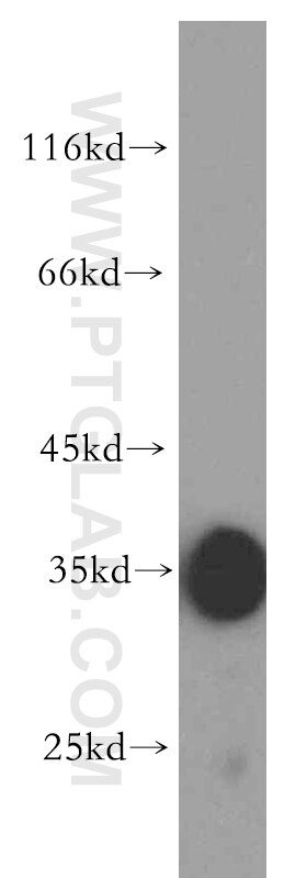 Follistatin Polyclonal antibody