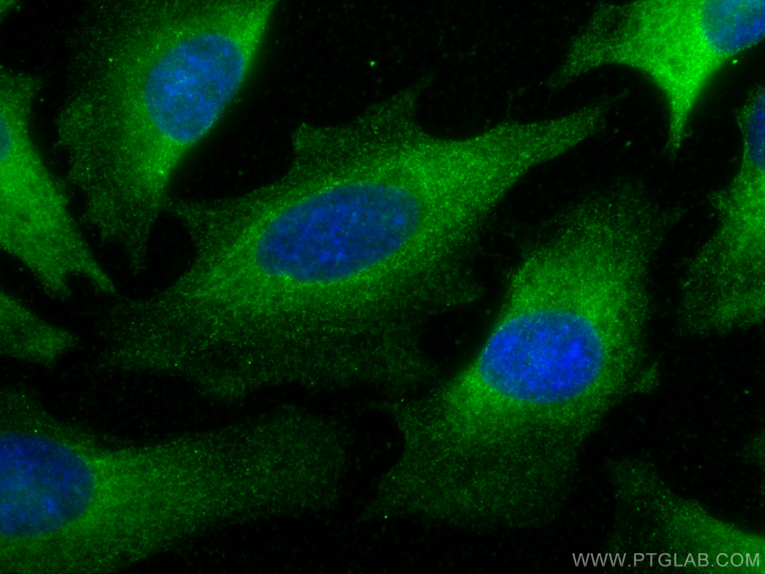 Immunofluorescence (IF) / fluorescent staining of HeLa cells using Follistatin Monoclonal antibody (60060-1-Ig)