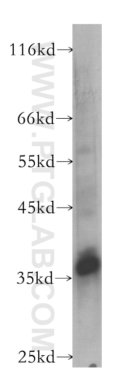 Western Blot (WB) analysis of Raji cells using Follistatin Monoclonal antibody (60060-1-Ig)