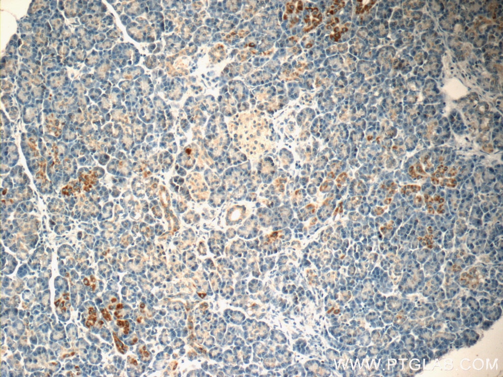 Immunohistochemistry (IHC) staining of human pancreas tissue using FSTL1 Polyclonal antibody (20182-1-AP)