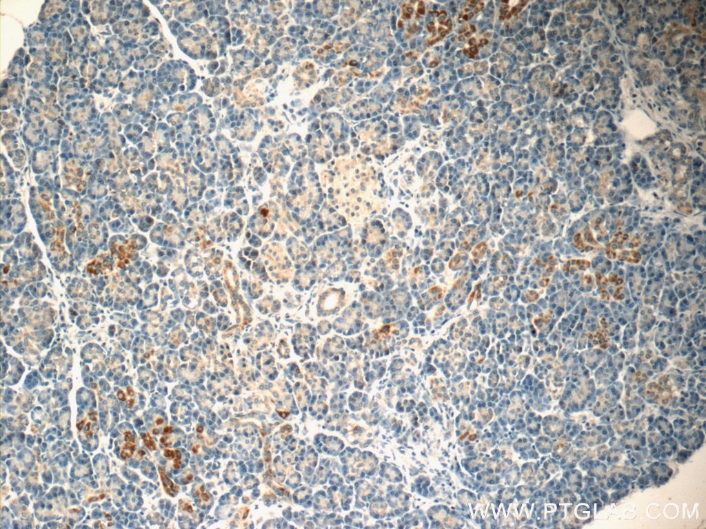 IHC staining of human pancreas using 20182-1-AP