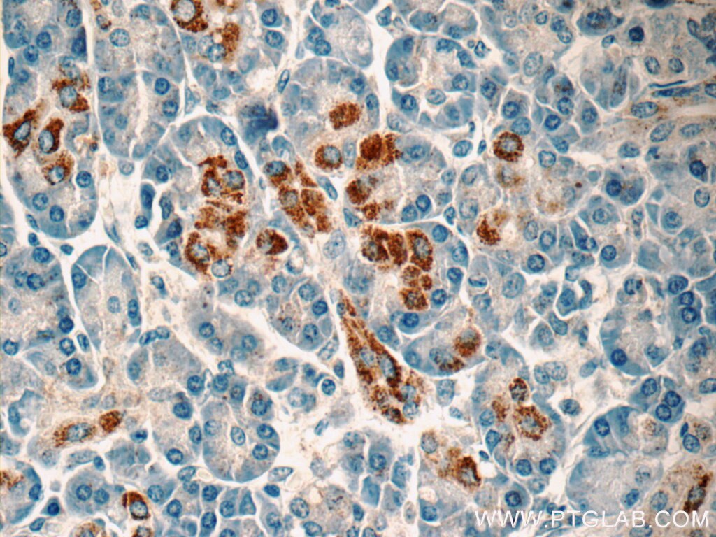 IHC staining of human pancreas using 20182-1-AP