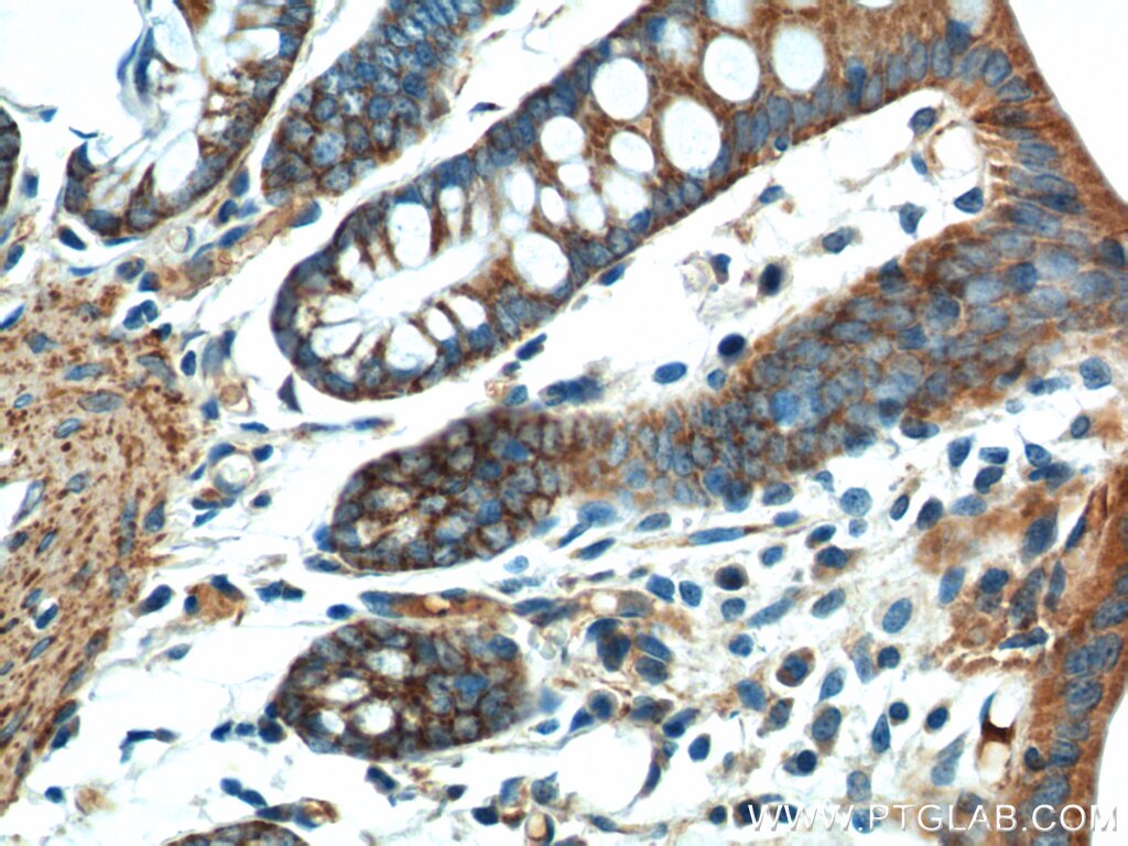 Immunohistochemistry (IHC) staining of rat colon tissue using FSTL1 Polyclonal antibody (20182-1-AP)